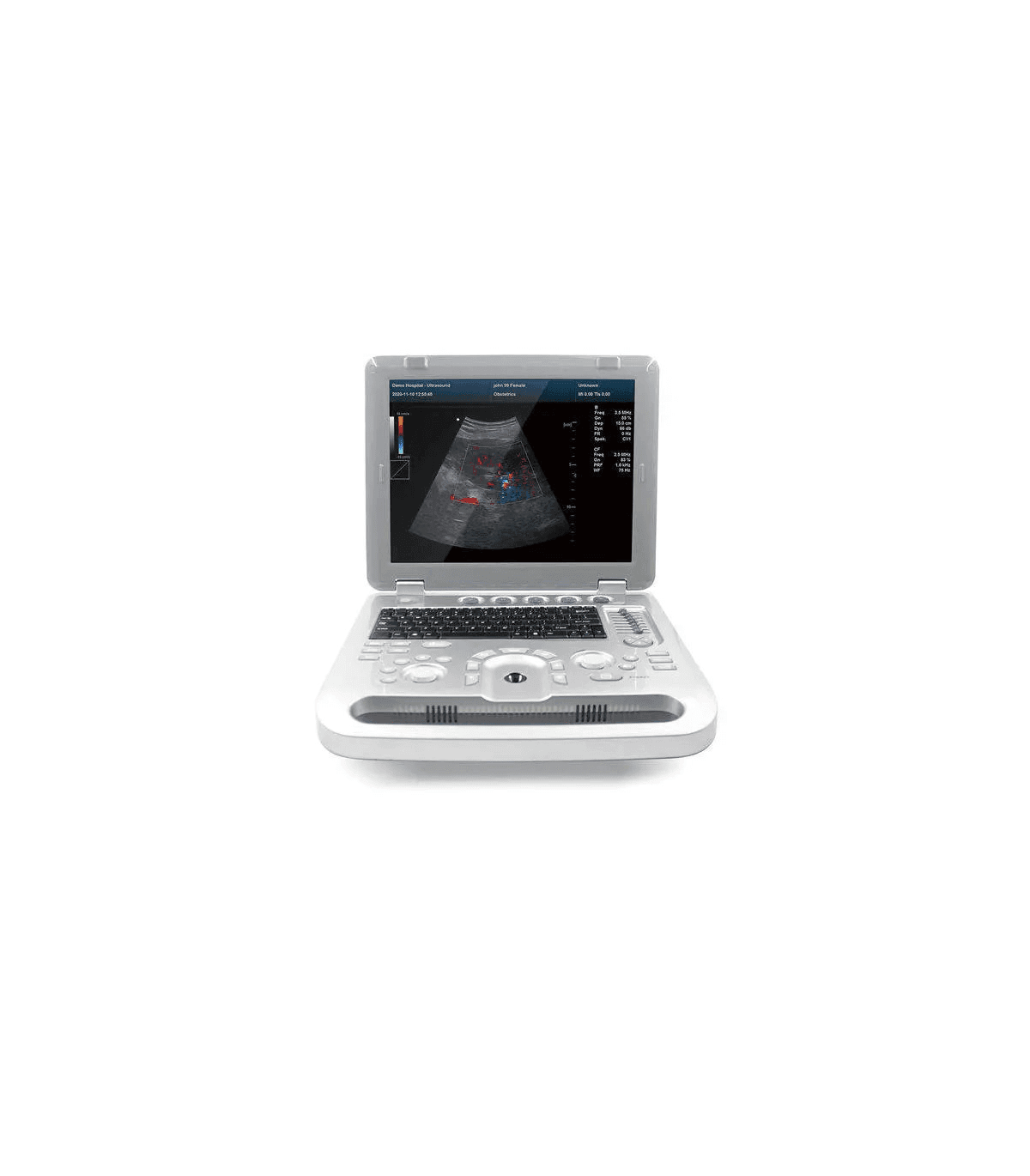 CMS1700B-Ecograf-Contec.png